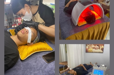 Nặng Mun Siêu Sạch