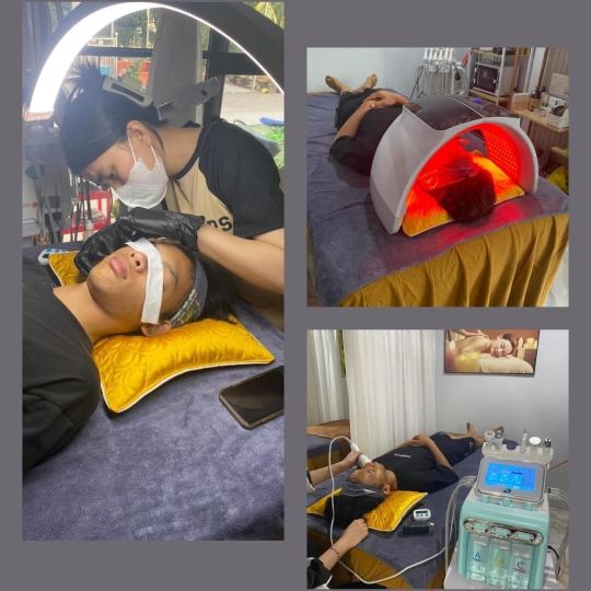 Nặng Mun Siêu Sạch